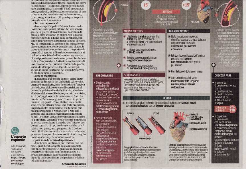 ischemi ainfarto2142